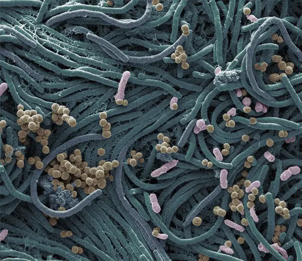 Close up images of bacteria