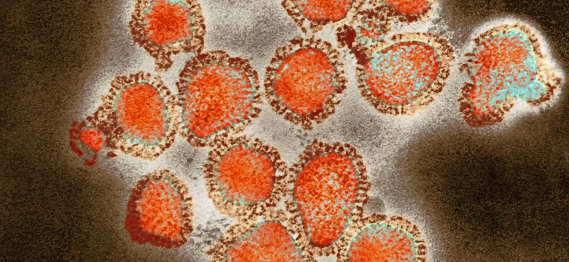 A close-up microscope image of the Hong Kong Flu virus taken in 1975 by Fr. Fred Murphy.