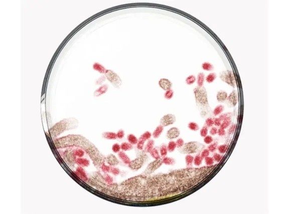 Image of Flu virus under a microscope