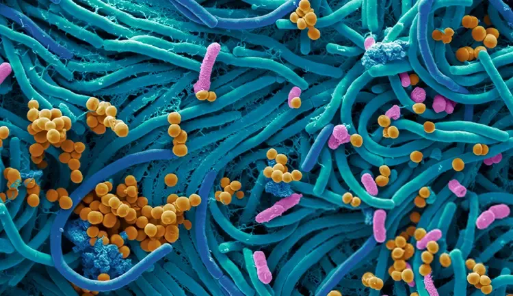 A close-up microscope image of a mixture of different germs and bacteria stained in bright colors.