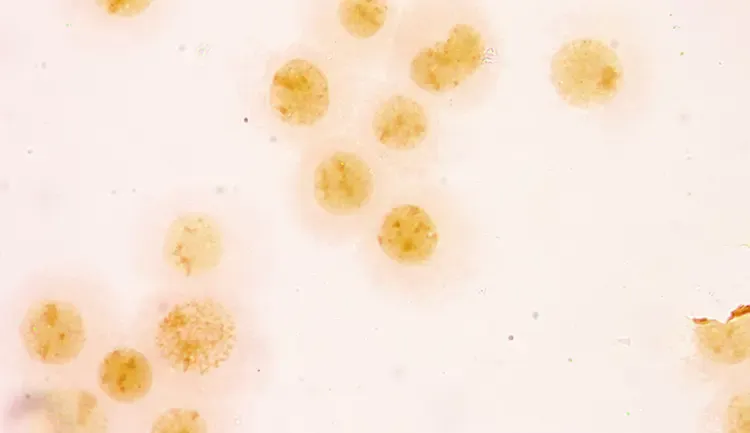 Image of germs stained yellow on microscope slide